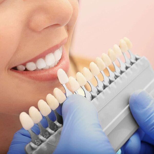 HB Odontologia Dentista em Itapema Facetas