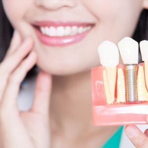 Implante dente em Itapema